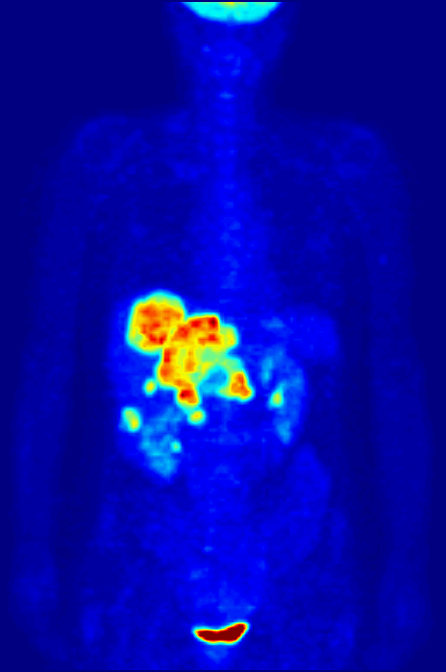 Sleep - brain scan with data visualization